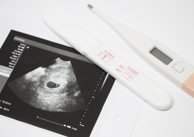 妊娠検診　超音波